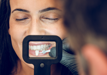 How to Take Care of Your Dental Veneers in Northampton