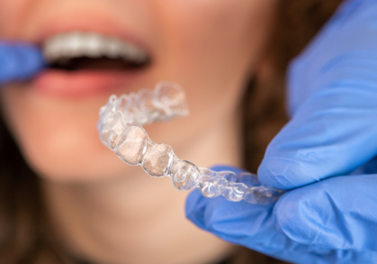 What Makes Invisalign So Popular in Northampton?