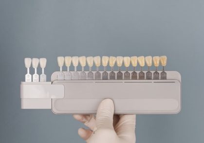 What Are Dental Veneers and How Do They Work?