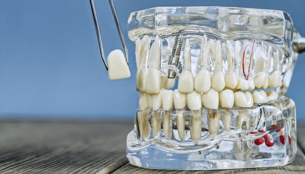 dentist northampton