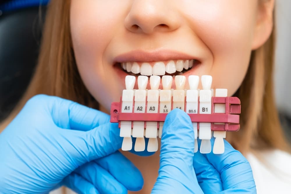 teeth whitening northampton