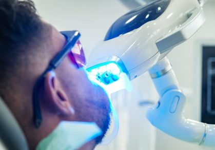How to Prepare for a Teeth Whitening Treatment