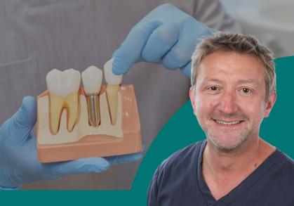 Dental Implants in Northampton: What They Are and Who They’re For