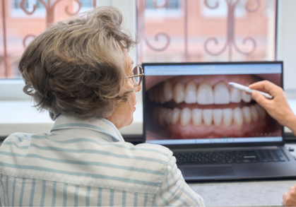 Full Mouth Rehabilitation: Restoring Your Smile, Function, and Confidence