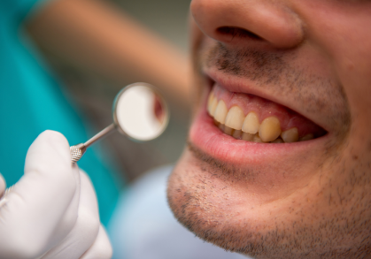 What Is Smile Design and How Does It Work?