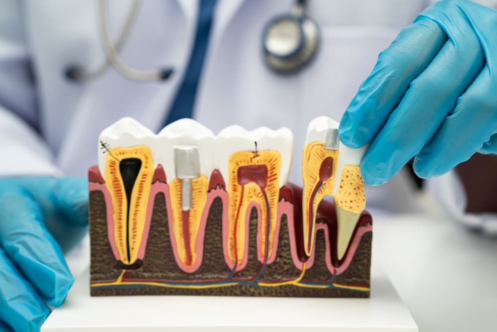 root canal vs extraction